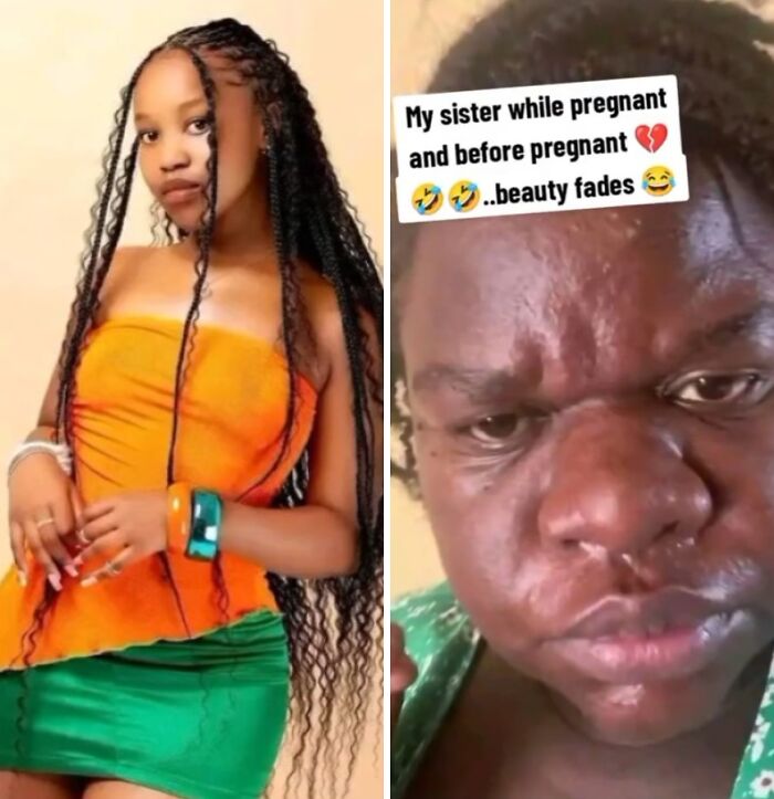 Comparison of a woman's physical appearance changes during pregnancy showing before and after photos side by side