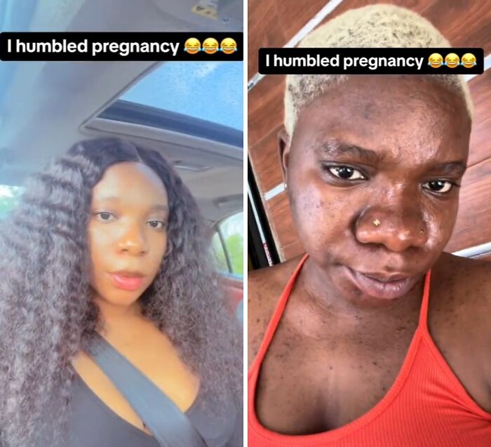 Two women showing changes in their physical appearance during pregnancy, highlighting pregnancy skin and hair differences.