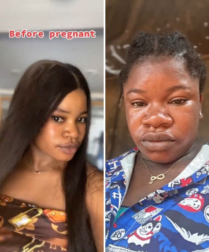 Side-by-side photos showing physical appearance changes in a pregnant woman before and during pregnancy.