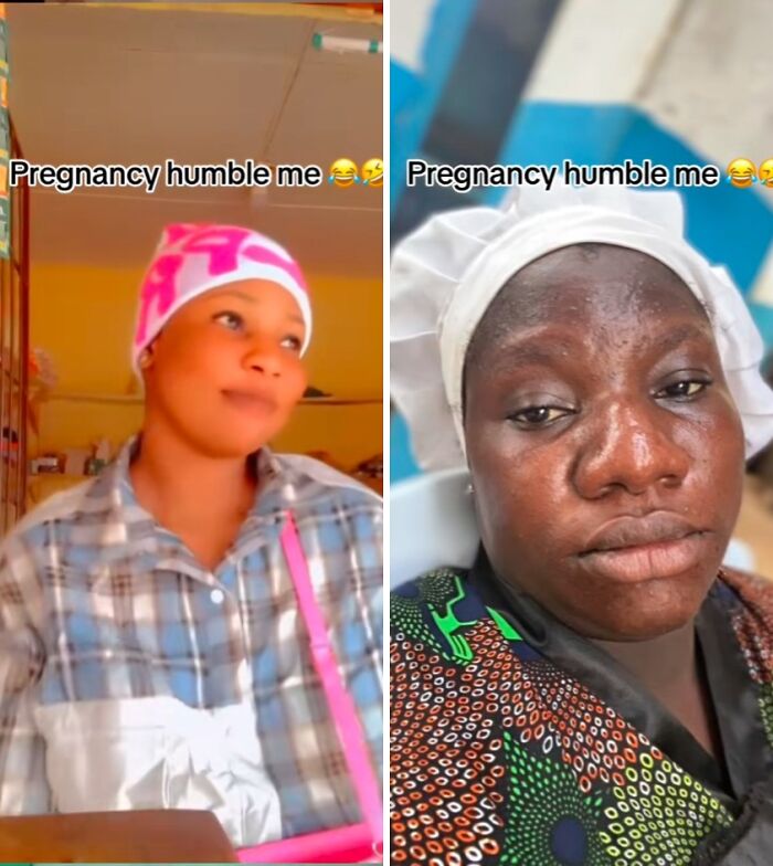 Two women showing physical appearance changes during pregnancy, highlighting natural skin and expression differences.