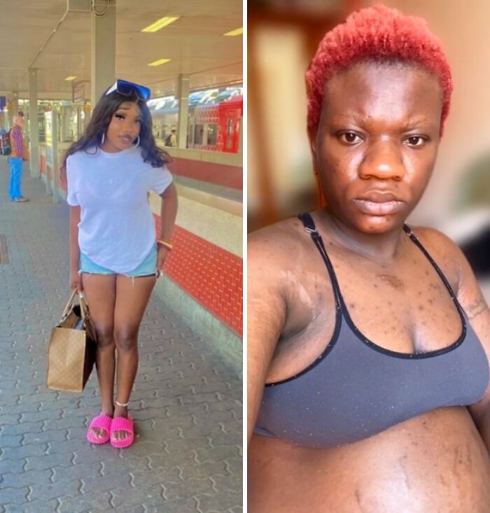 Side-by-side photos of a woman before and during pregnancy showing physical appearance changes in women.