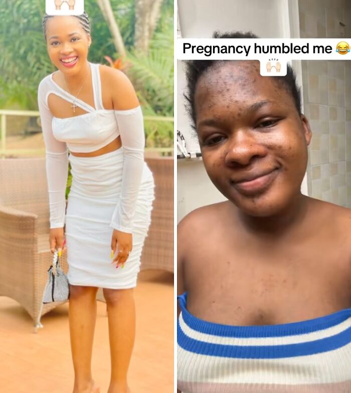 Before and during pregnancy photos of a woman showing physical appearance changes experienced during pregnancy.