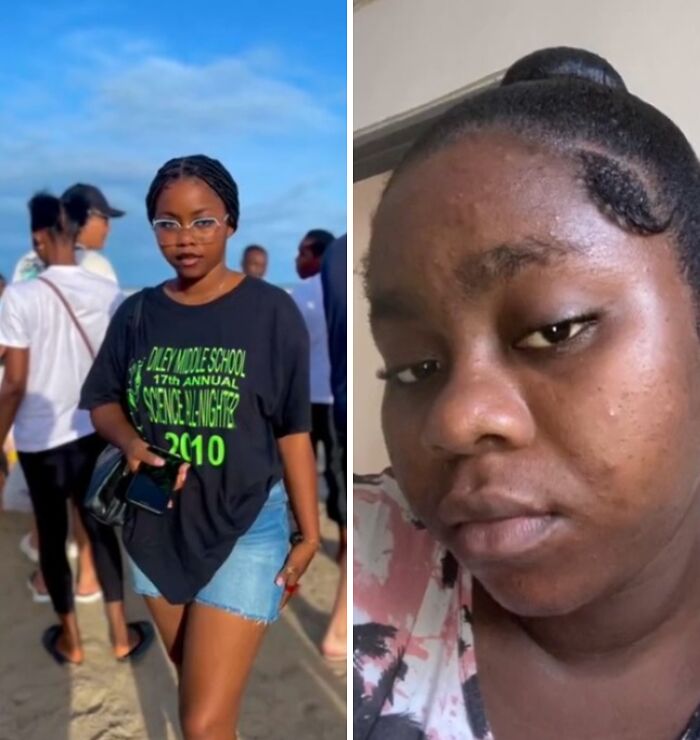 Side-by-side images showing changes in women's physical appearance during pregnancy with clear skin and casual attire.