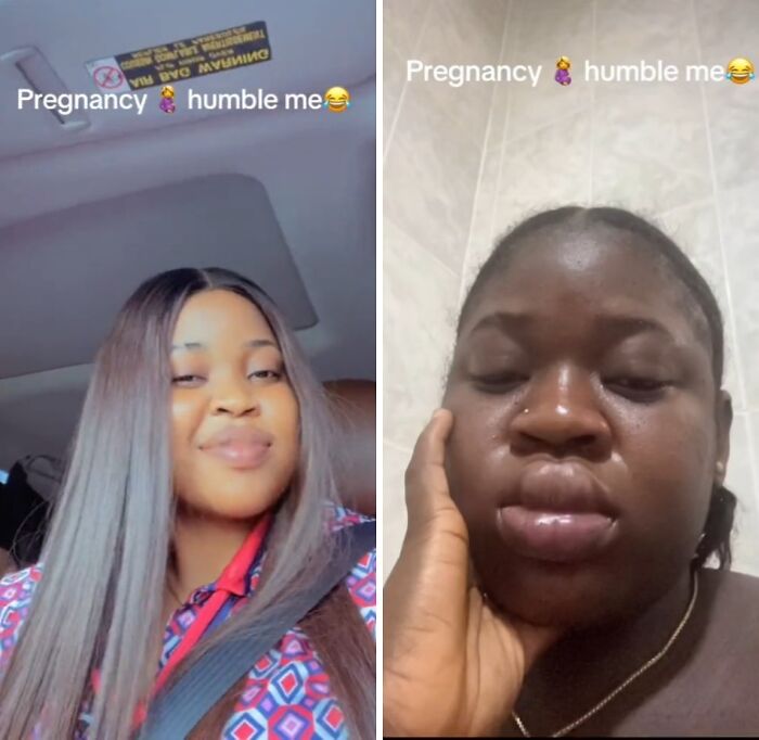 Side-by-side photos showing how physical appearance changed during pregnancy with swelling and skin differences.