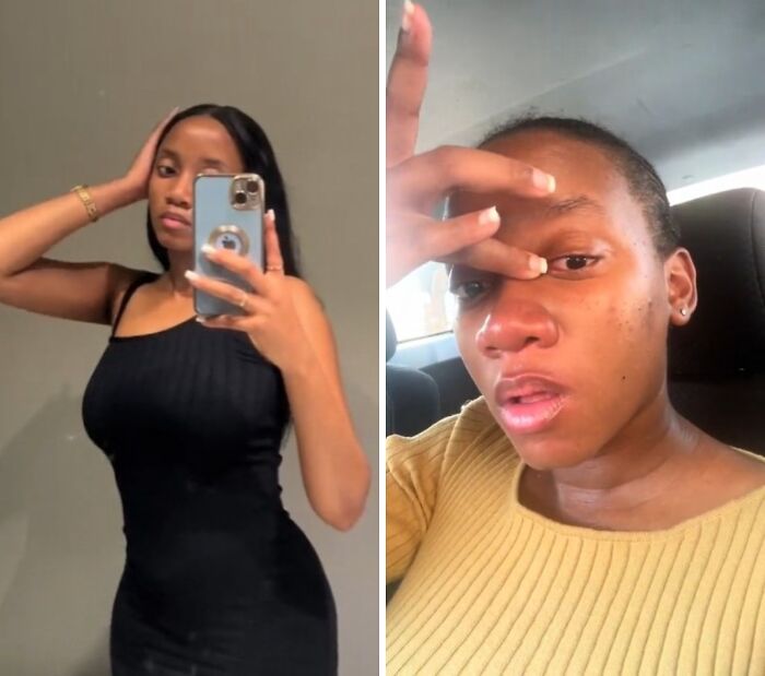 Before and during pregnancy photos of a woman showing physical appearance changes and skin variations during pregnancy journey.