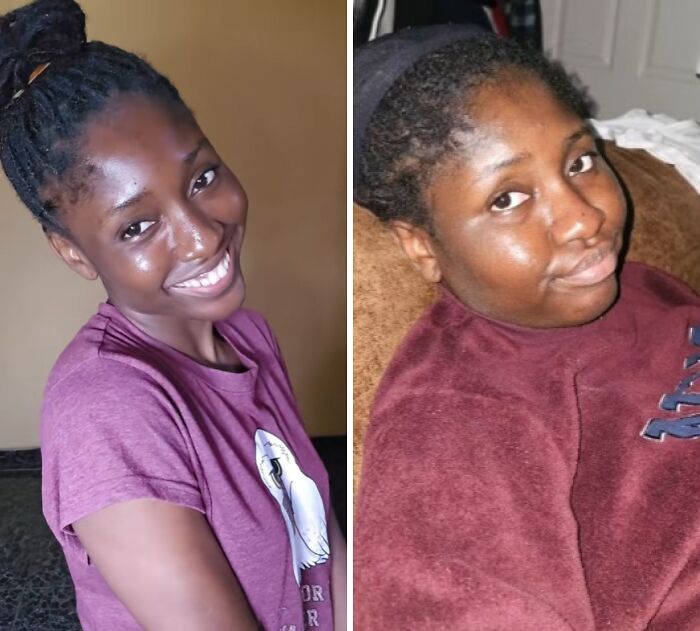 Side-by-side photos of a woman showing changes in physical appearance during pregnancy with noticeable differences in facial expression and posture.