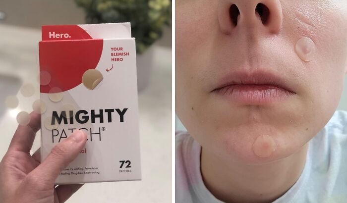 Mighty Patch acne pimple patches shown on Amazon, a popular internet gold product for blemish treatment.