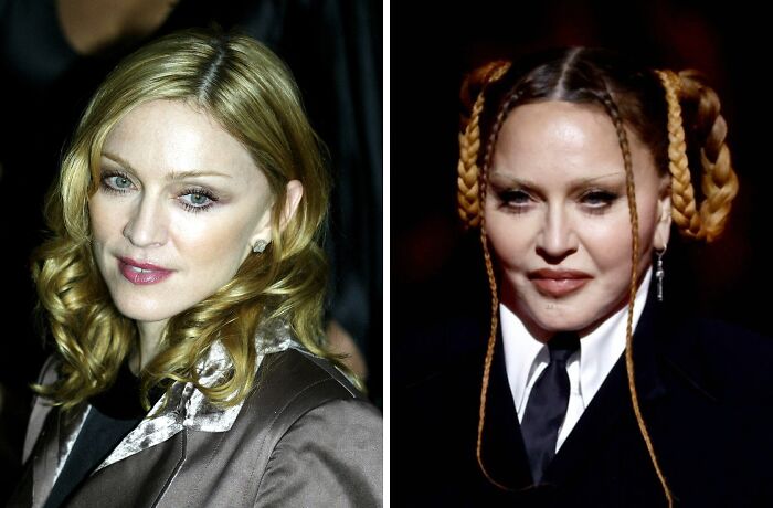 Celebrity before and after plastic surgery comparison showing changes in facial features and hairstyle.