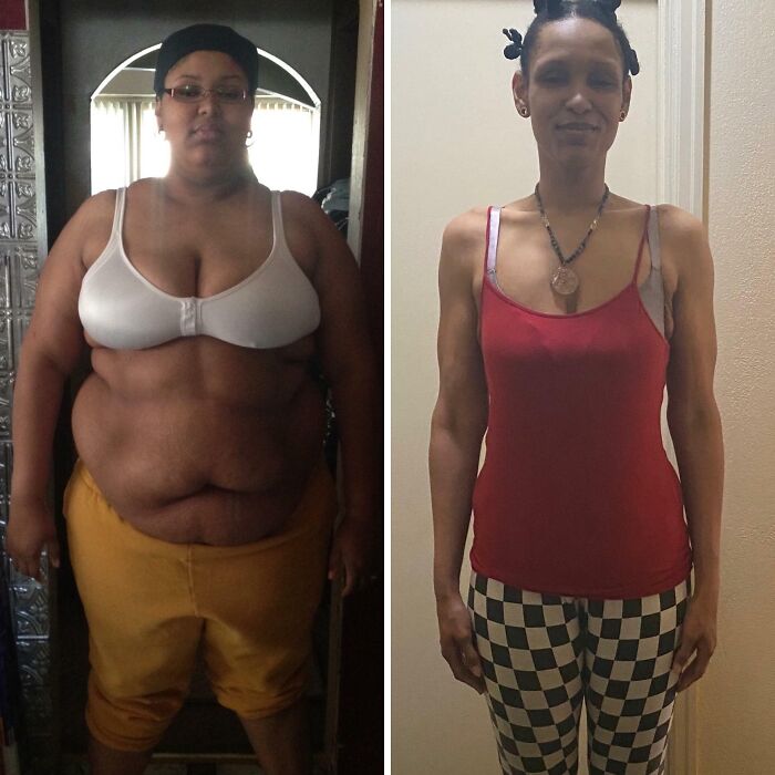 Side-by-side inspiring weight loss before and after pictures showing dramatic body transformation and health improvement.