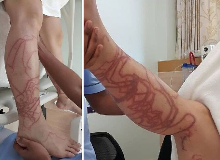 Fotos médicas que muestran marcas fascinantes en la piel, destacando patrones inquietantes en piernas y brazos.
