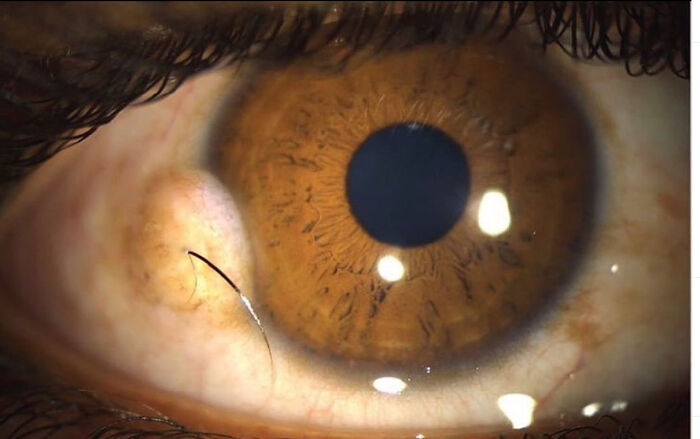 Primer plano de ojo marrón con detalle de pestaña encarnada en imagen curiosa del cuerpo humano.