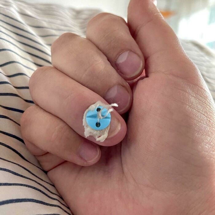 Mano con dedo vendado que muestra botón azul, imagen curiosa del cuerpo humano y su capacidad de curación natural.