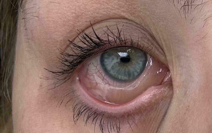 Close-up of human eye showing detailed skin texture and blood vessels, highlighting bizarre and fascinating human body features.