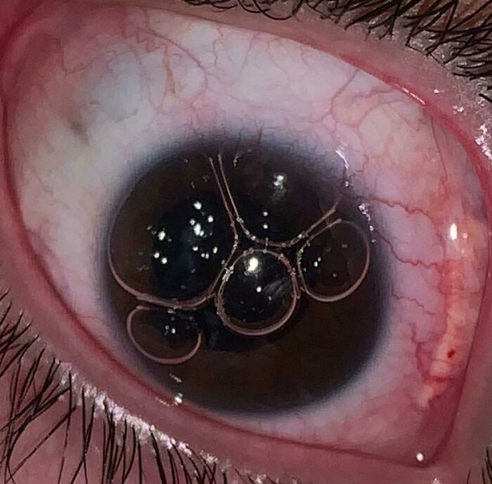 Primer plano de ojo humano con burbujas reflejadas en la córnea, imagen interesante y curiosa del cuerpo humano.