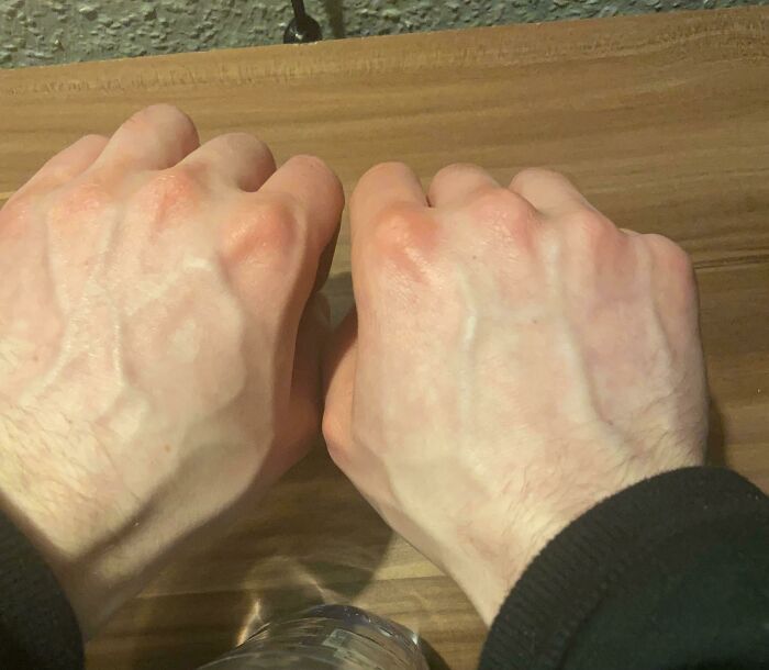 Two human hands with visible veins resting on a wooden surface, showcasing unique aspects of the human body.