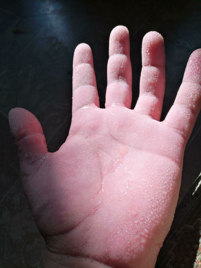 Close-up of human body hand with skin showing unusual water droplets, highlighting bizarre and fascinating texture details.