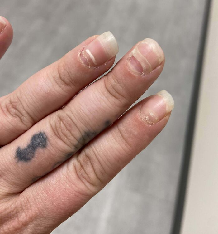 Close-up of human fingers with damaged nails and a small tattoo, showing bizarre and fascinating details of the human body.