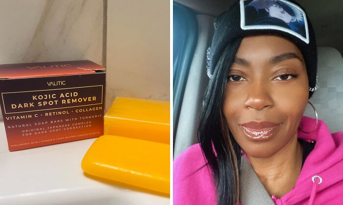 Kojic acid dark spot remover soap bars next to a woman with clear skin wearing a black beanie and pink hoodie.