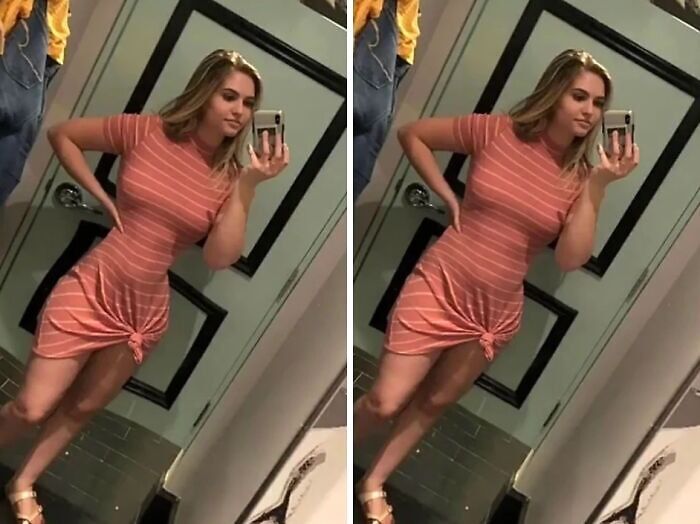 Side-by-side images of a woman in a striped dress, highlighting heavy editing on Instagram influencer posts.