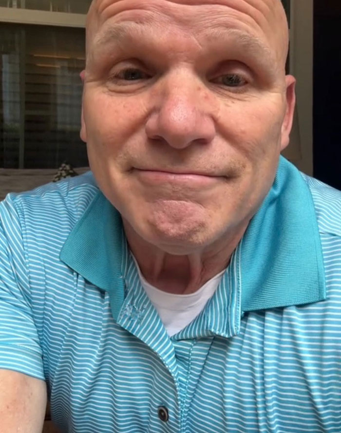 Close-up of a bald man in a blue striped polo shirt discussing the US losing money in the tourism sector.