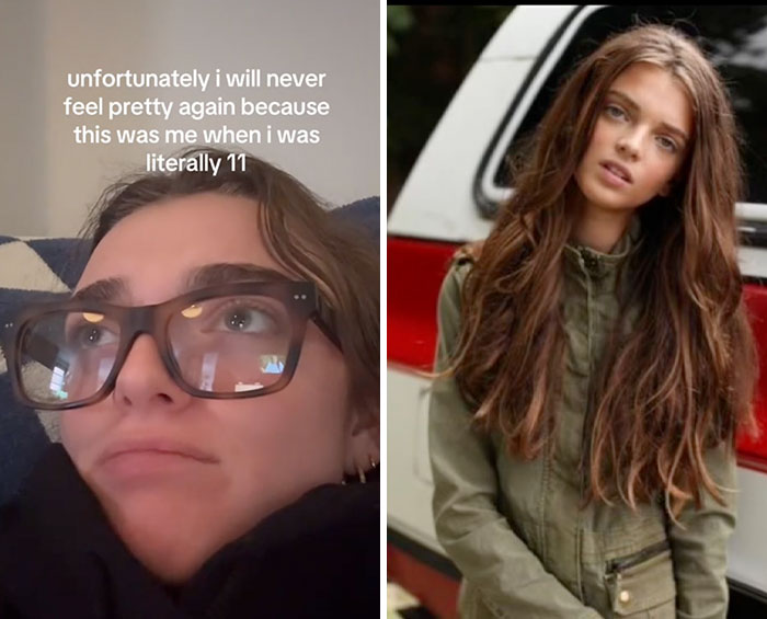 Side-by-side images showing a woman’s glow down over time illustrating the people share glow downs trend.