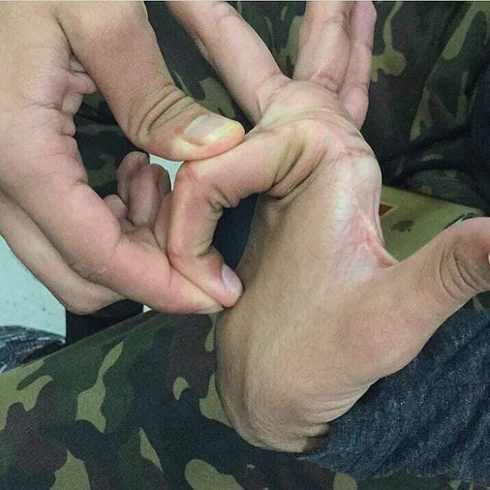 Close-up of a hand being pulled in an unusual way illustrating moments when medicine crossed into the uncanny world.