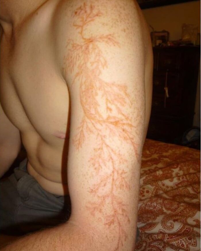 Close-up of a person's arm showing a detailed vascular pattern resembling medicine crossing into the uncanny.