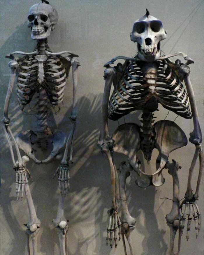 Human and primate skeletons displayed side by side, illustrating uncanny moments in medicine and anatomy history.