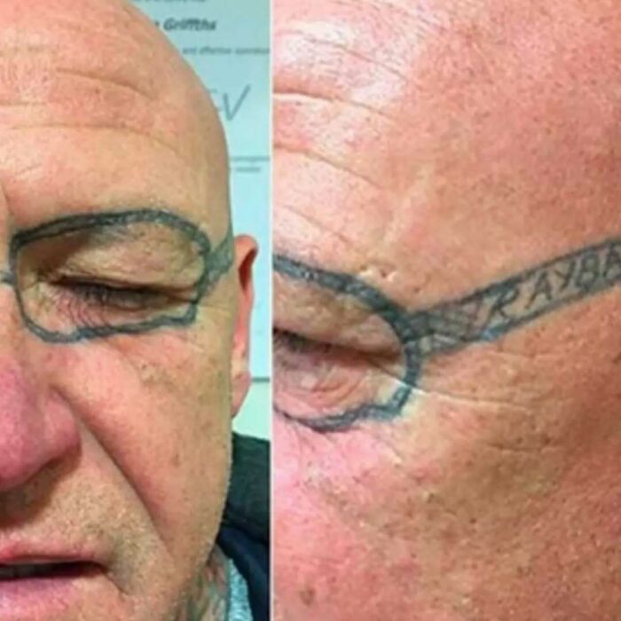 Close-up of a man’s face with a funny and bad tattoo of eyeglasses drawn around his eye.