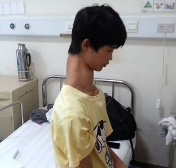 Young man with an unusual neck deformity sitting on a hospital bed, illustrating uncanny moments in medicine.