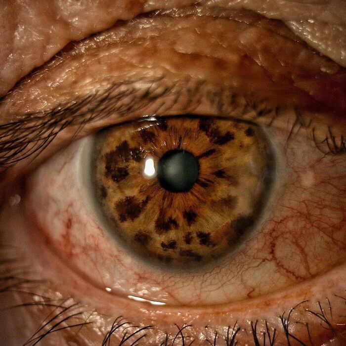 Close-up of a human eye with detailed iris patterns showcasing uncanny moments in medicine and unusual eye conditions.