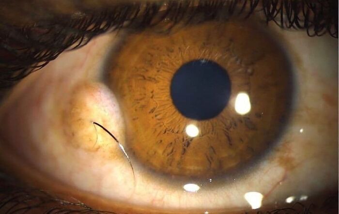 Primer plano del ojo marrón con detalle médico, mostrando una apariencia fascinante e inquietante de fotos médicas.