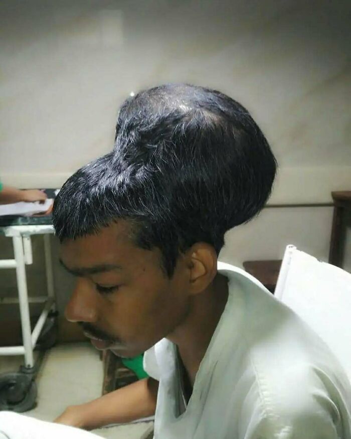 Man sitting in a medical setting with an uncanny large growth on the back of his head, illustrating moments in medicine.