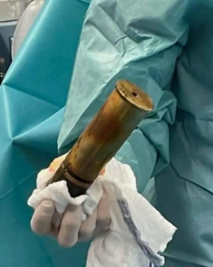 Medical professional in surgical attire holding a large rusty metal object during an uncanny medical moment.