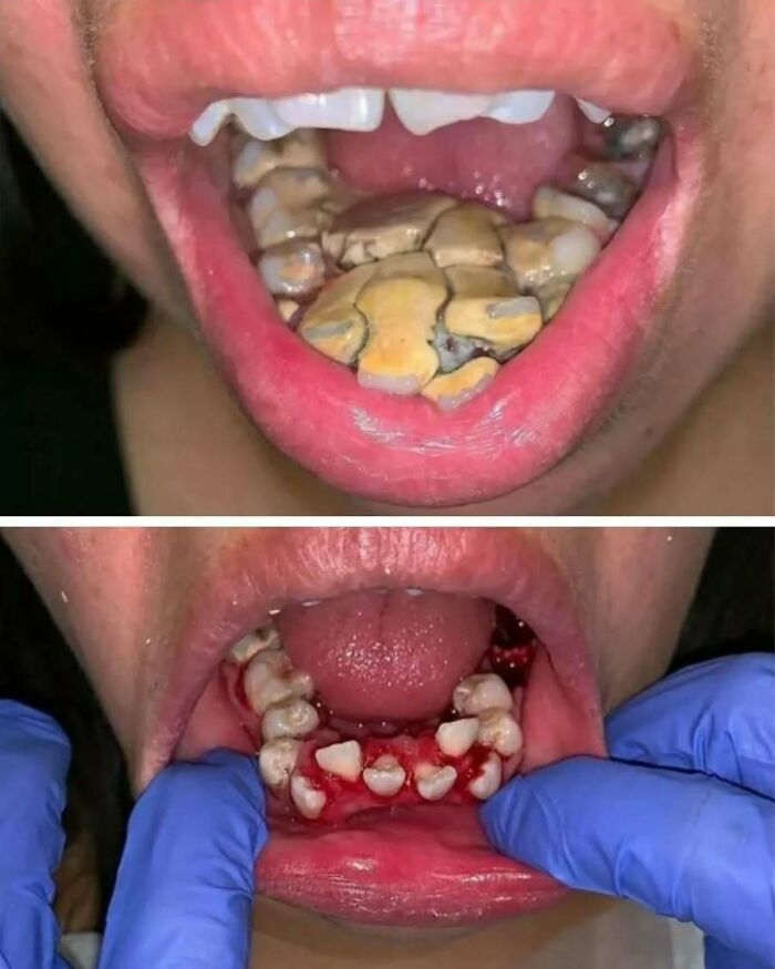 Close-up of a mouth with severely decayed teeth contrasted with a medical procedure, highlighting uncanny moments in medicine.