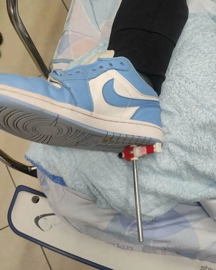 Patient's foot in a sneaker treated with an external fixation device, showcasing a moment when medicine crossed into the uncanny.