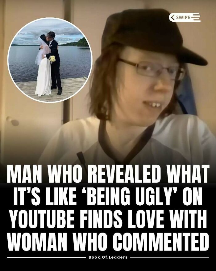 Young man sharing his story about being ugly on YouTube finds love, a fact that might teach you something new.
