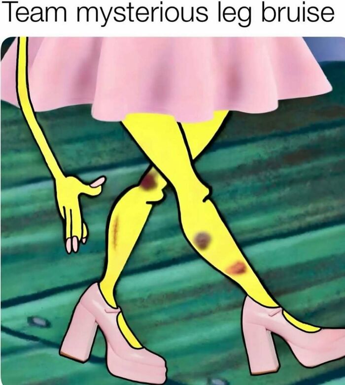 Cartoon character with bruised yellow legs wearing pink shoes and a skirt, a relatable meme about avoiding responsibilities.