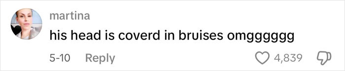 Comment on social media saying his head is covered in bruises, related to ET's Baby and Island Boy bullying incident.