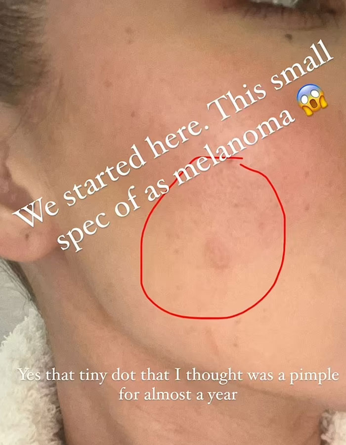 Close-up of a face showing a red circled area with unsettling plastic surgery stitches on the skin. Close-up of a face showing a red circled area with unsettling plastic surgery stitches on the skin.