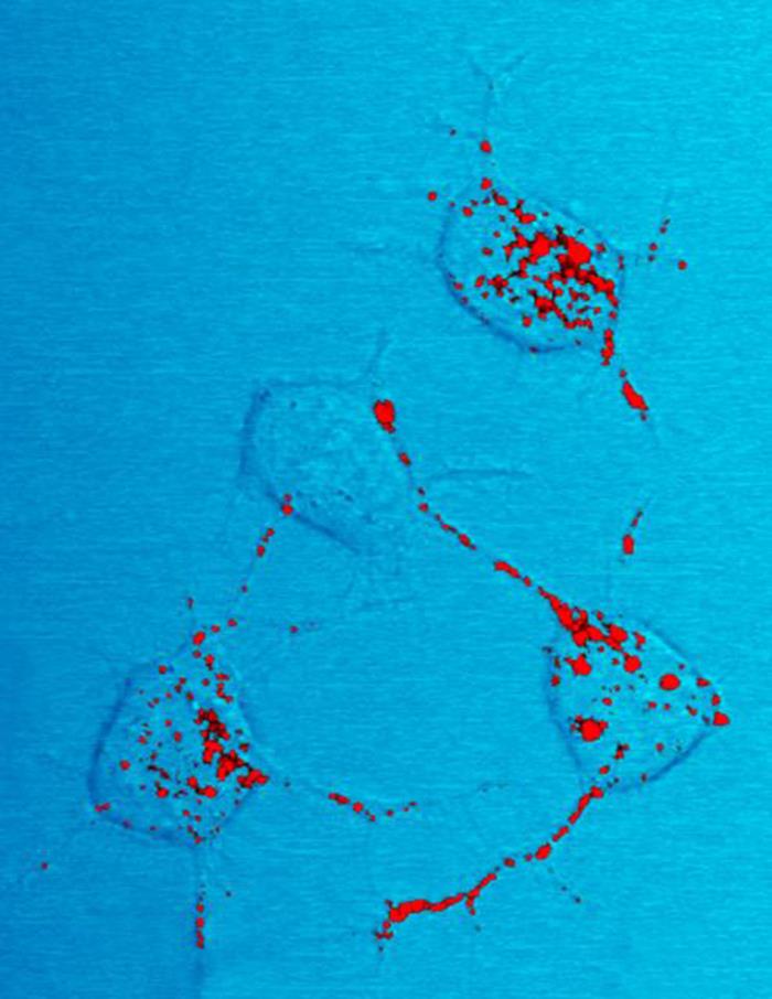 Microscopic image showing cells with red markers highlighting serotonin syndrome effects on cellular structures.