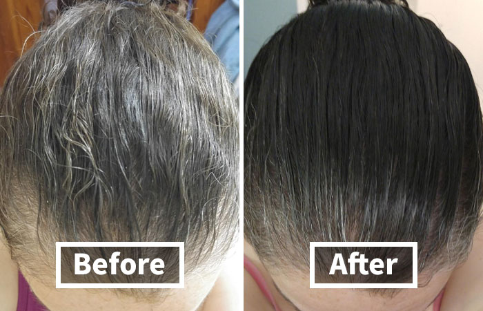 Before and after images showing hair improvement and growth from a popular product among bestsellers pandas are buying now.