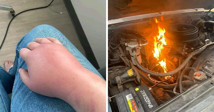 “Anything Gone Wrong”: 50 Funny Fails People Shared Online Just To Cope