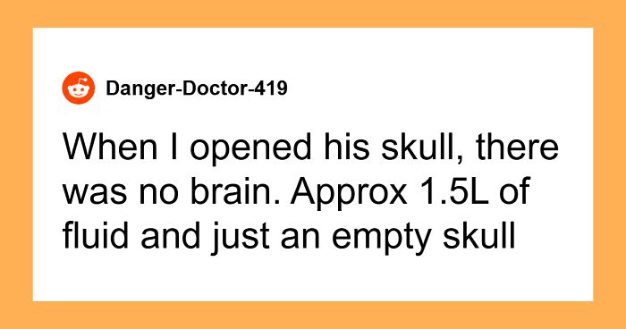 45 Autopsy Experts Reveal Their Weirdest And Most Unique Finds: “There Was No Brain”