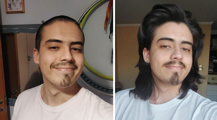Young man showing a stunning hair transformation with a before image of short hair and after with long, thick hair.