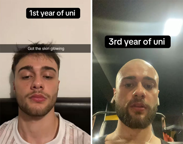 Before and after comparison of an engineering student in 1st year with glowing skin and 3rd year looking stressed and tired.