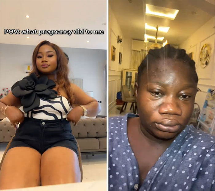 Two women showing physical appearance changes during pregnancy, highlighting diverse pregnancy transformation experiences.