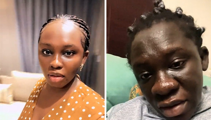 Women Are Sharing What They Looked Like Before Getting Pregnant To Highlight Extreme Changes