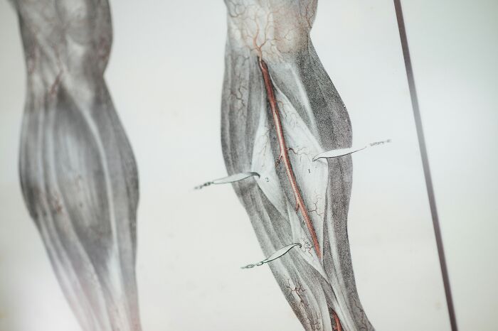 An anatomical illustration of the lower leg muscles and veins, relevant to plastic surgeons and cosmetic procedures.