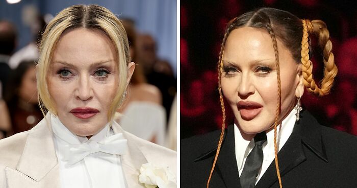 66YO Madonna Brings Back Natural Look At Met Gala 2025 After Concerning Plump Cheeks And Pout
